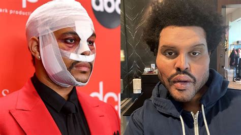 the weeknd plastic surgery makeup